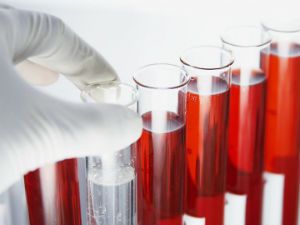 Анализы на алкоголь в крови 
