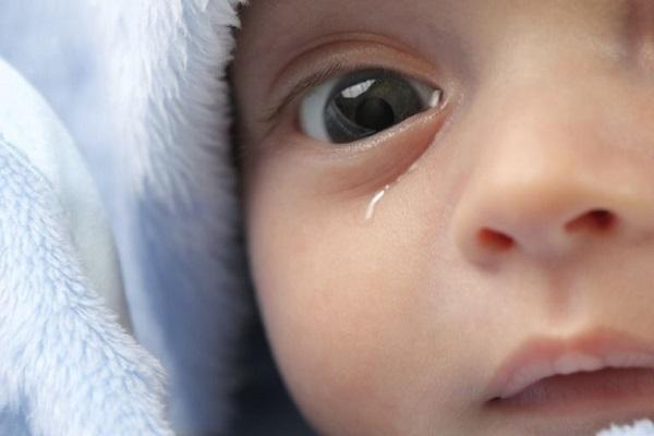 Закисание глаз у новорожденных 