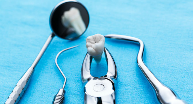 Болит голова после стоматолога: что можно и что нельзя делать после удаления зуба 