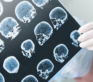 Что показывает МРТ головы? Особенности диагностики 