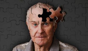 Симптомы и лечение деменции Альцгeймеровского типа 