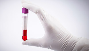 Что это такое макропролактин: анализ и норма в крови 