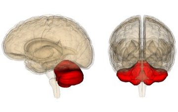 Инсульт мозжечка головного мозга: симптоматика, тактика терапии и последствия 
