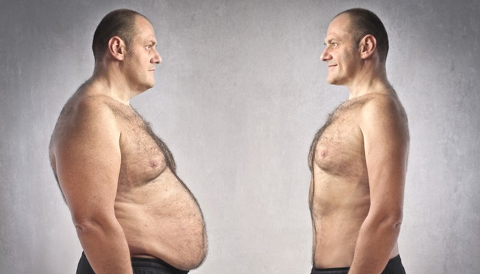 Абдоминальное ожирение у мужчин и женщин: причины и лечение 
