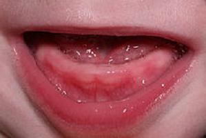 Как помочь ребёнку, когда режутся зубки? Первые зубы крохи 