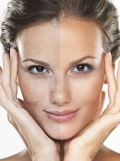 Зачем нужна проверка зрения