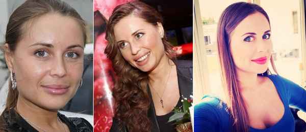  Юлия михалкова фото до и после операции