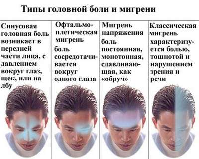 Головная боль: мигрень