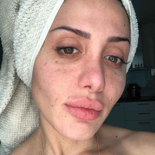 Оксана Овсепян до и после пластики: фото лица и носа без макияжа