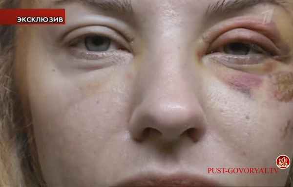 «Стыд и ком в горле»: жена Марата Башарова впервые подтвердила слухи об избиении и заявила о разводе