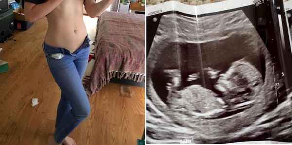 «Нам уже пять месяцев»: Кабаева подтвердила беременность и показала смелые фото с заметным животиком
