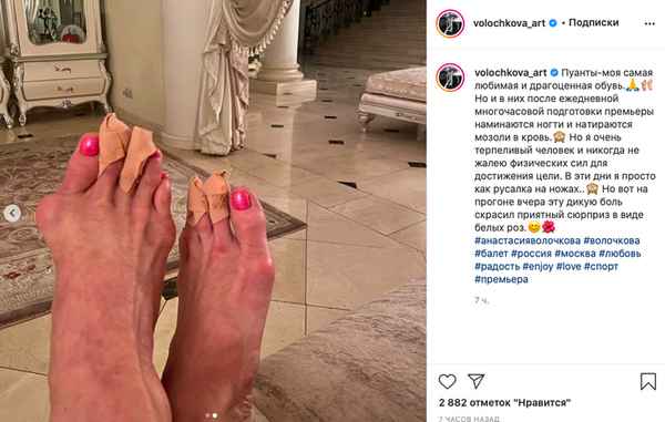 «Боль дикая»: Анастасия Волочкова и Эвелина Бледанс сильно повредили стройные ноги на заграничном отдыхе