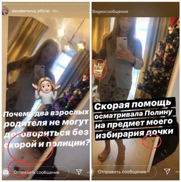 «Наркоманка с залитыми глазами»: у Даны Борисовой случились разборки со скорой и полицией из-за строптивой дочери