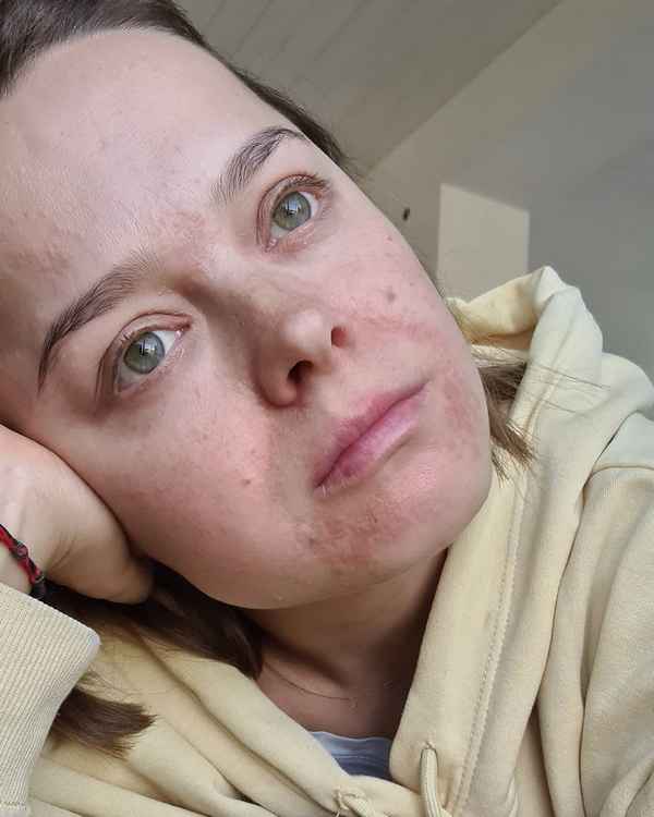 «Я просто очень устала»: актриса Comedy Woman Наталия Медведева впервые честно рассказала о болезни