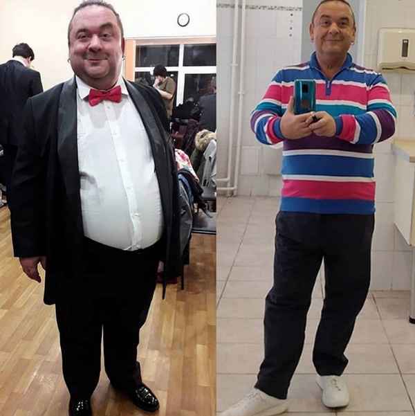 Александр Морозов из "Кривого зеркала" похудел на 40 килограммов после операции по уменьшению желудка