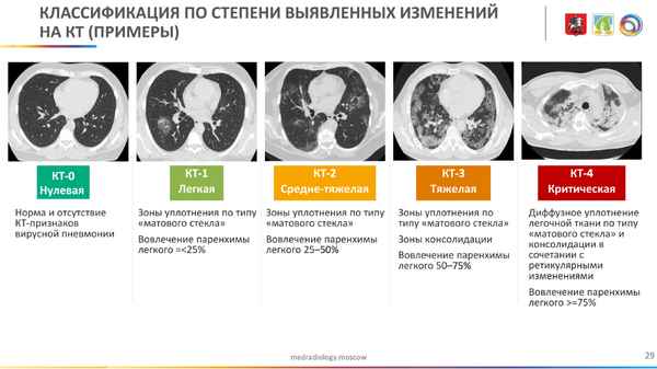 Поражение легких 80 %: Юрий Куклачев переболел коронавирусом и рассекретил размер своей пенсии