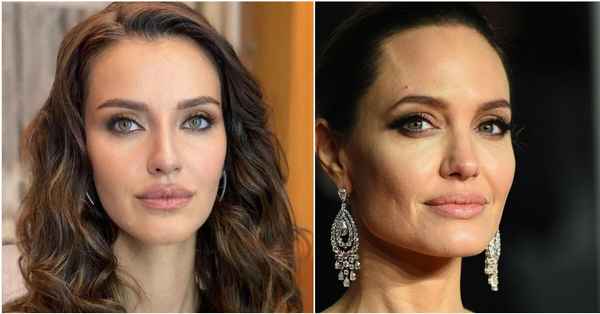 Звезда "Великолепного века" стала копией Анджелины Джоли: уколы красоты изменили внешность турецкой актрисы