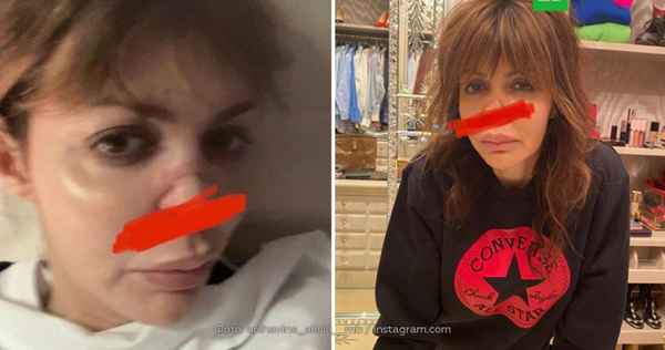 Бывшая жена Аршавина сравнила себя с Юлией Началовой: у Алисы Казьминой диагностировали серьезное заболевание