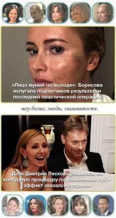 «Лицо мумии на выходе»: Борисова испугала подписчиков результатом последней пластической операции